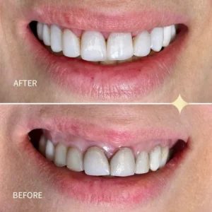 505434493_17925215130080280_6192