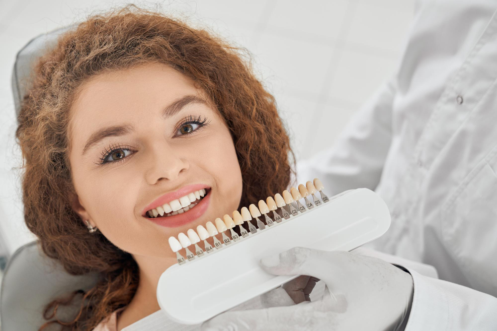 Composite Veneers