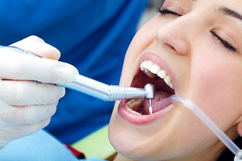 Dental Restoration