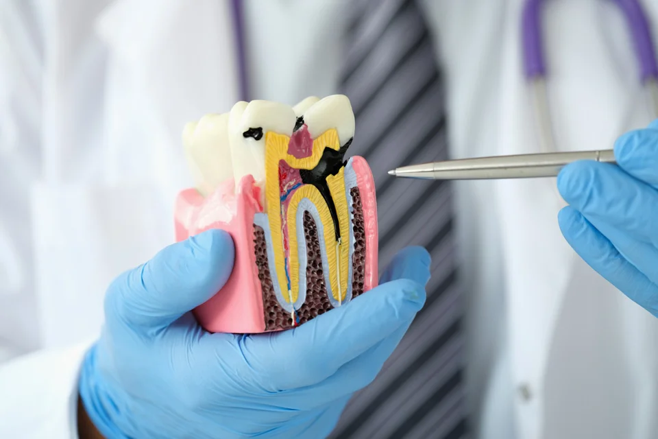 Endodontics